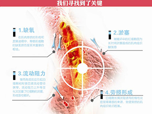 只需一分鐘，肩頸很輕松！——恒怡運(yùn)動(dòng)是有效的